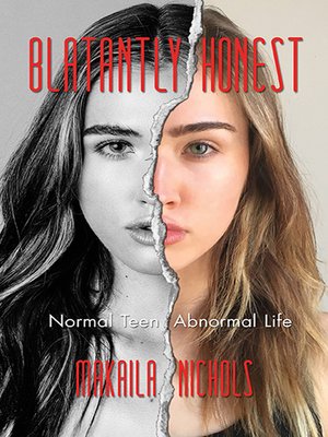 cover image of Blatantly Honest